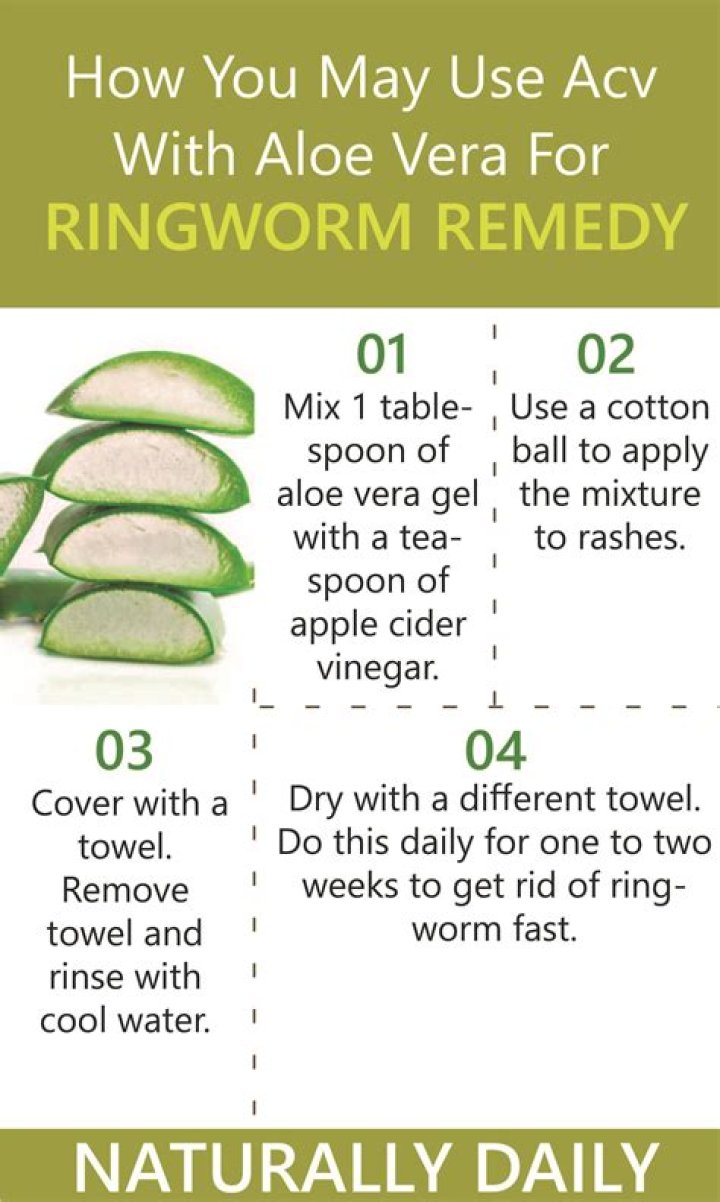 Does heat kill ringworm?