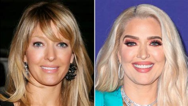 Erika Jayne nose job