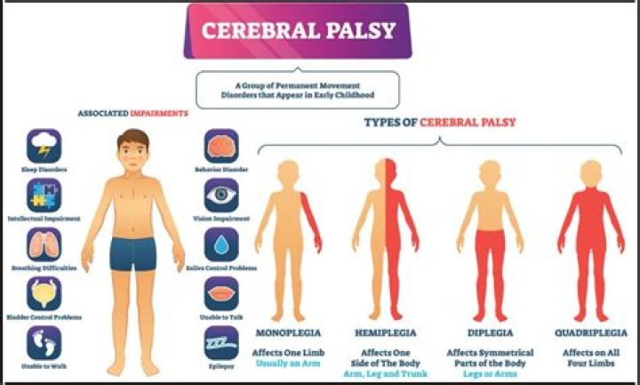Is cerebral palsy the same as multiple sclerosis?