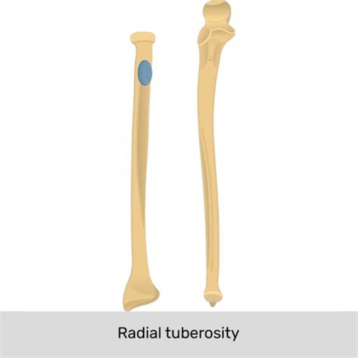 What does the radial tuberosity do?